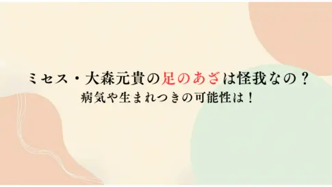 ミセス・大森元貴の足のあざは怪我なの？-病気や生まれつきの可能性は！