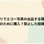 メルカリでエコー写真の出品する理由は？-誰が何のために購入？禁止した経緯まとめ